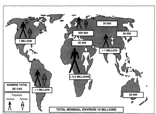 Graphique  1.  Répartition estimative mondiale des cas de séropositivité chez l'adulte Début  1992