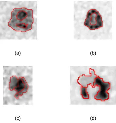 Fig 2. Four examples of simulated tumors. Red contours correspond to the simulation ground  386 