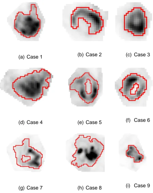 Fig  3.  (a-i)  Clinical  images  of  9  NSCLC  tumors.  Red  contours  correspond  to  the  statistical  399 