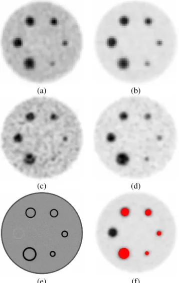 Fig.  2.  Different  images  used  in  the  segmentation  study;  (a)  ratio  4:1,  2  min acquisition time, 64 mm3 voxels, (b) ratio 8:1, 2 min, 64 mm3, (c) ratio  4:1, 2 min, 8 mm3, (d) ratio 8:1, 2 min, 8 mm3, (e) CT acquisition, (f)  voxel-by-voxel gro