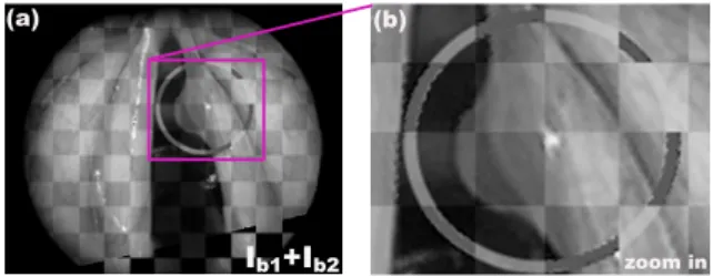 Figure 8: Numerical registration results: (a) shows I b1 inte- inte-grated in I b2 , and (b) a zoom in of region of interest.