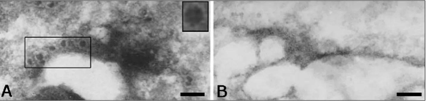 Figure 3. Papaya latex analysis by transmission electron microscopy (TEM). (A) Diseased  and (B) healthy latex samples were studied by TEM, which revealed the PMeV particles  (highlight) on the polymers