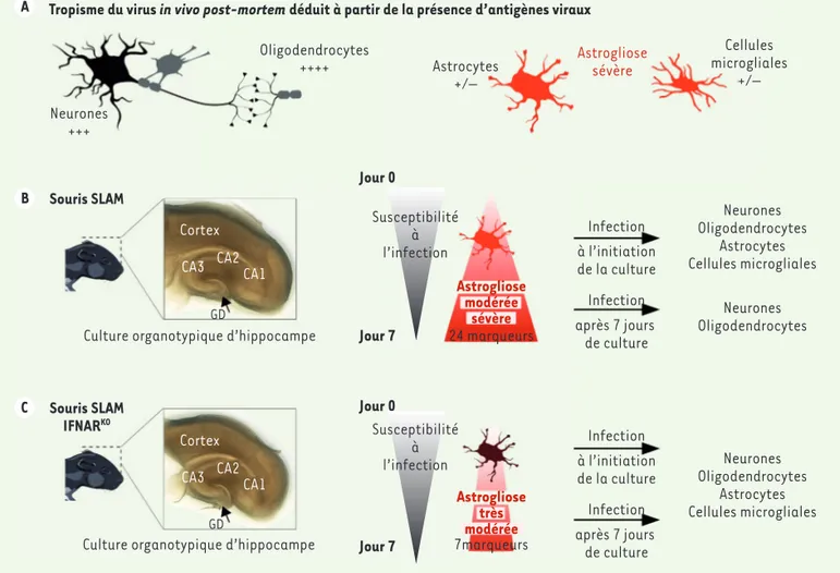 Figure 1. (A) Pathologie de l’infection par le virus de la rougeole dans le système nerveux central chez l’homme au moment du décès et chez la souris  transgénique au moment de l’euthanasie