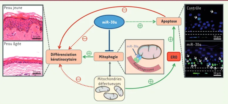 Figure 2. Implication du miR-30a dans le vieillissement épidermique. La surexpression du miR-30a dans un modèle organotypique d’épiderme  reconstruit augmente considérablement le taux de kératinocytes en apoptose (marquage TUNEL vert, encadré de droite) et