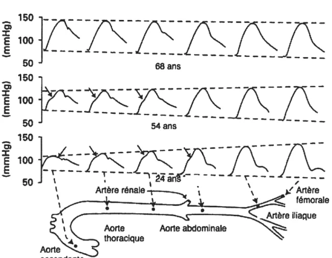 Figure 3. Propagation de la pression pulsée (PP) de l’aorte ascendante vers les artères périphériques à différents âges chez l’homme.
