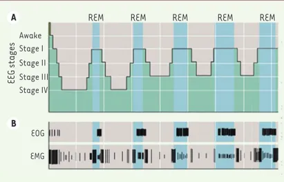 Figure 1. Les différentes phases du sommeil. L’électroencéphalogramme permet  de distinguer différentes phases (I à IV) du sommeil à ondes lentes et le  som-meil paradoxal, à activité rapide
