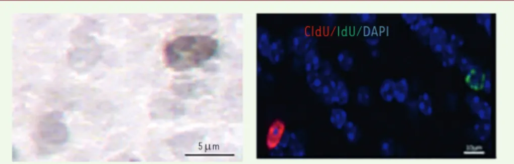 Figure 1. Coupes de bulbes olfactifs de souris adultes, montrant la présence de neurones nés  récemment dans la zone sous-ventriculaire des ventricules latéraux