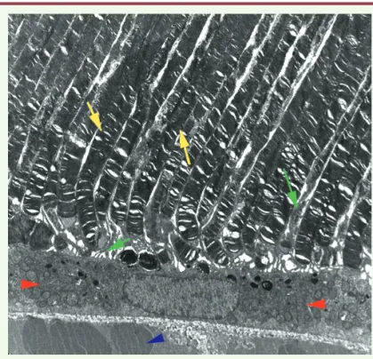 Figure 2.  Micrographie électronique de l’EPR. Les pointes de flèche rouges  encadrent une cellule de l’EPR