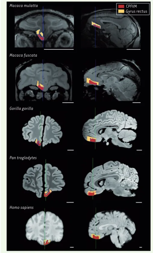 Figure 1.  Délimitation des régions cérébrales d’intérêt dans cinq espèces de primates