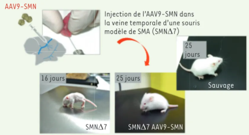 Figure 1. Un vecteur AAV9 contenant le gène SMN1 (AAV9-SMN) a été injecté par  voie intraveineuse (veine temporale) un jour après leur naissance à des souris  modèle de SMA