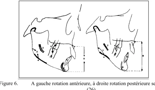 Fig.  5-12  À  gauche  :  Rotation  antérieure  de  la mandibule.  A  droite  :  Rotation  postérieure  de  la   mandi-bule  (selon  Bjôrk).