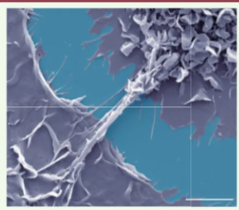 Figure 1.  Formation de nanotubes membra- membra-naires entre les macrophages. Des  macro-phages humains sont traités par le CmMTB et  infectés par le VIH-1, puis fixés et analysés  en microscopie électronique à balayage