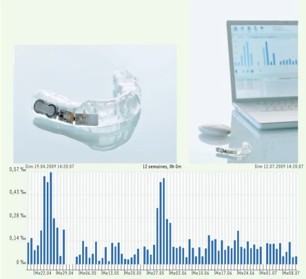 Figure 4. La gouttière den- den-taire intelligente comme  support d’essai de la  pla-teforme technologique pour  les implants intelligents,  et pour la détection et le  traitement du bruxisme