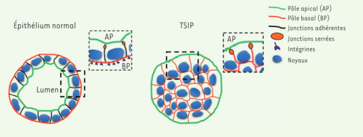 Figure 1.  Organisation  d’un épithélium normal ou  transformé.  Les cellules  épithéliales sont  polari-sées et leur pôle basal (BP)  est tourné vers la matrice  extracellulaire