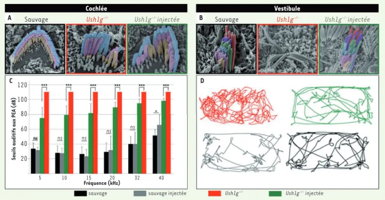 Figure 2. Le transfert viral de l’ADNc codant la protéine Sans restaure la structure et la fonction des cellules sensorielles de l’oreille interne