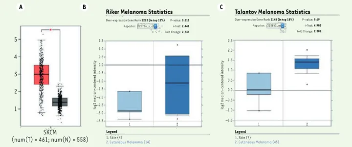 Figure 1. Overexpression of SLC25A15 in melanoma patients from TCGA and Oncomine databases