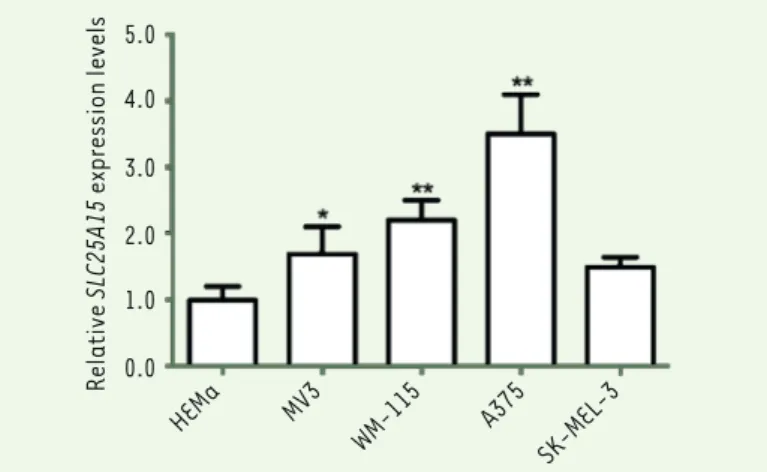 Figure 3. Overexpression of SLC25A15 in melanoma cell lines by q-PCR. Data are  represented as means ± S.D