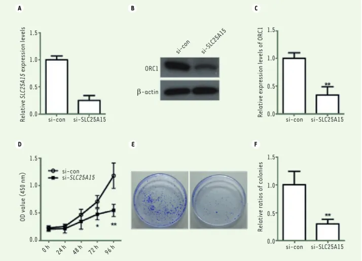 Figure 4. SLC25A15 knockdown inhibits the proliferation of A375 cells. A. Relative expression levels of SLC25A15 in A375 cells after treatment with  small interfering RNA (q-PCR)
