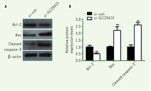 Figure 5. Silencing SLC25A15 promotes the  apoptosis of A375 cells. (A) Representative  images of the expression of Bcl-2, Bax and  cleaved caspase-3 by western blot  analy-sis
