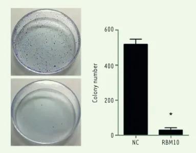 Figure 3.  Overexpression of RBM10 inhibits the migration and  invasion of U2OS osteosarcoma cells