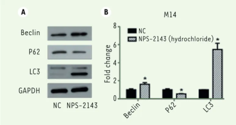 Figure 2. NPS-2143 (hydrochloride) promotes M14 cell autophagy. A.  Western  blots r show that the expression of Beclin and LC3 is raised following the  treat-ment of M14 cells by NPS-2143, while that of P62 decreases