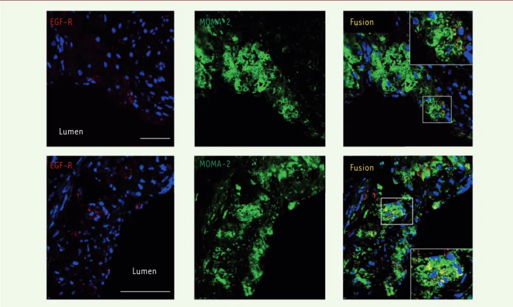 Figure 1. L’EGF-R est exprimé dans les plaques d’athérosclérose. Marquage par immunofluorescence révélant la présence du récepteur de l’EGF  (epidermal growth factor, EGF-R) (en rouge) dans les plaques d’athérosclérose de souris Ldlr -/-  à un stade précoc