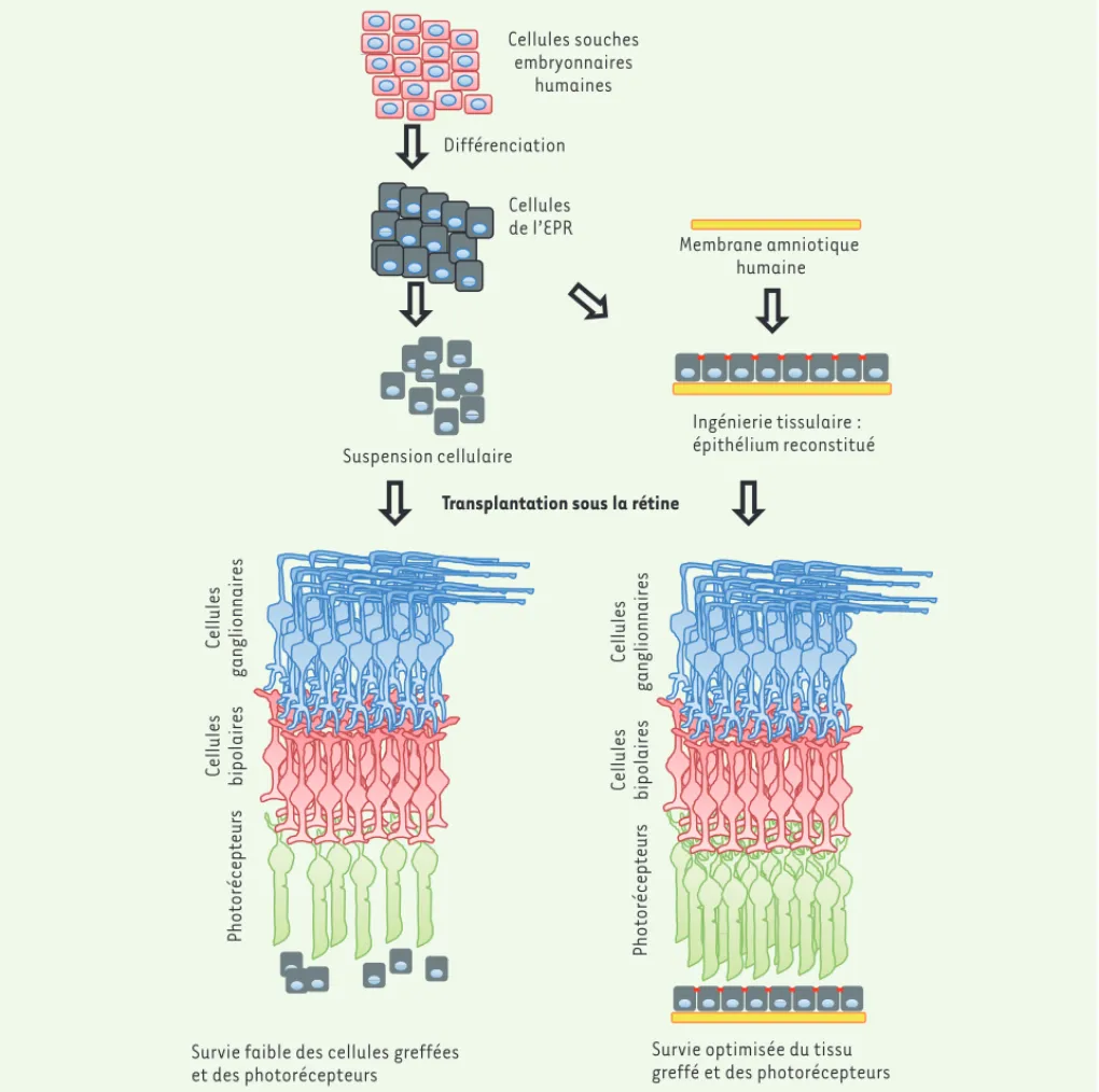 Figure 2. Schéma décrivant les deux méthodes de formulation du produit de thérapie cellulaire et les effets sur la rétine.