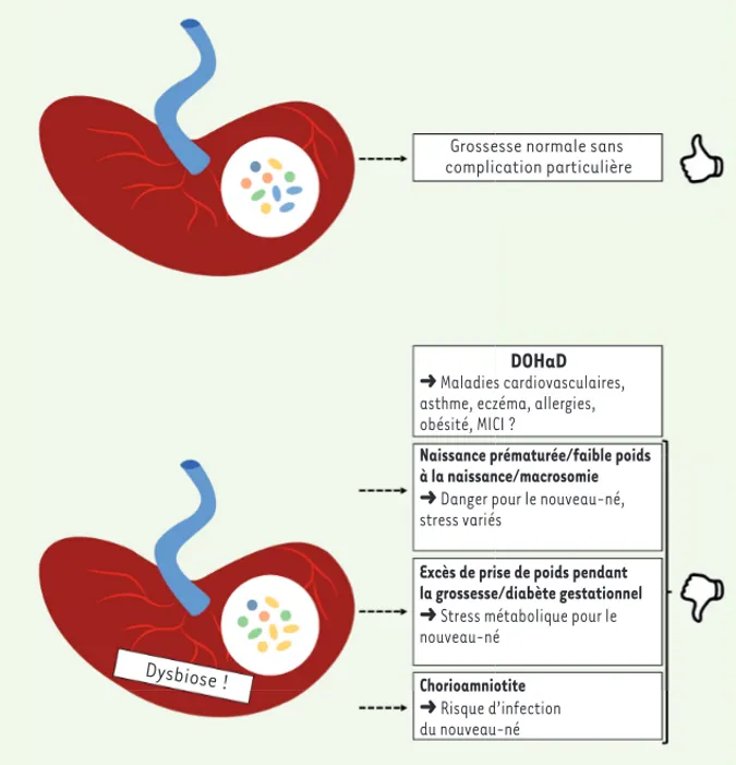 Figure 2.  Microbiote placentaire dans la  théorie de la DOHaD (developmental origin  of health and diseases)
