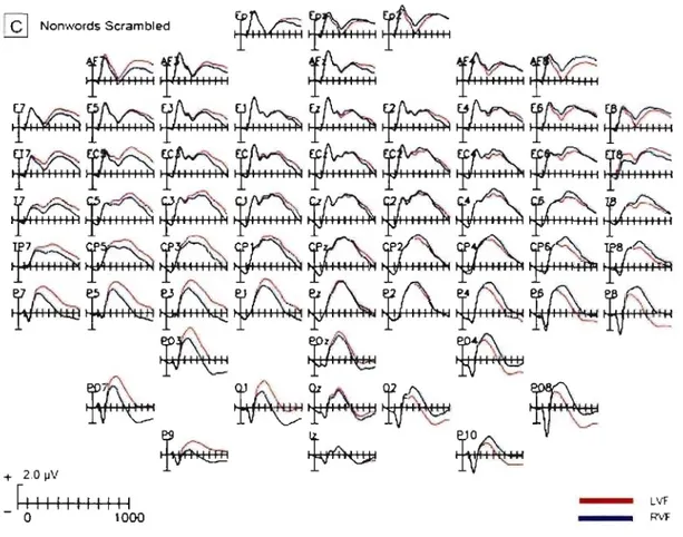 Figure  2.  Panel  C:  Grand  averaged  waveforrns,  collapsed  across  groups,  at  ail  electrode  sites  from  the  nonword  scrambled condition