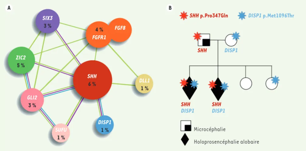 Figure 1. Génétique et transmission de l’holoprosencéphalie. A. Représentation simplifiée du réseau de gènes impliqués dans l’holoprosencéphalie