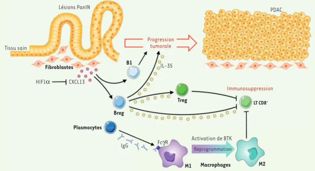Figure 1. Mécanismes d’action protumorale des lymphocytes B dans l’adénocarcinome canalaire pancréatique