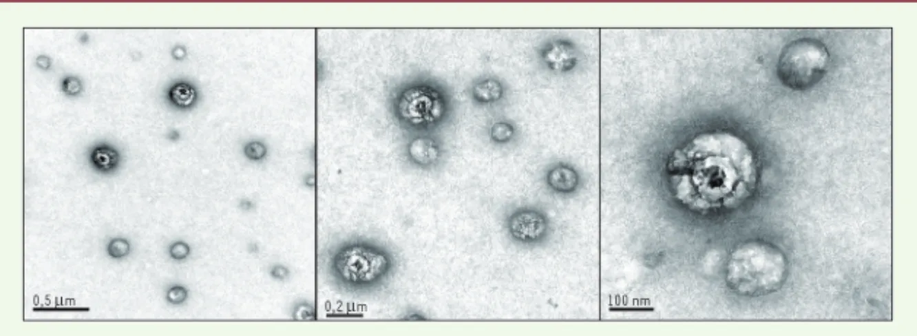 Figure 1. Les particules immuno-capturées chez les patients constituent une population mixte
