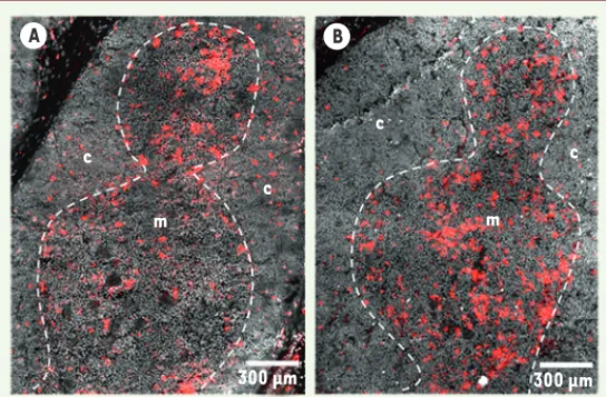 Figure 1. Immunofluorescence sur une section de thymus humain (6 μm) avec un  anticorps anti-CD19 humain (A) ou anti-IgM humain (B)