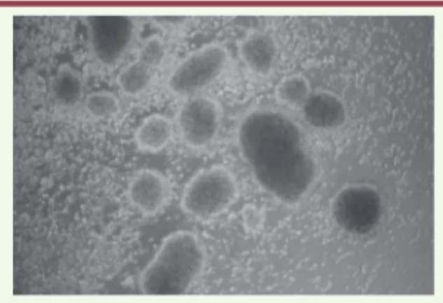 Figure 1. Lignées lymphoblastoïdes transfor- transfor-mées par le virus. Ce visuel montre l’effet de  l’infection des lymphocytes B du sang  péri-phérique par le virus d’Epstein-Barr