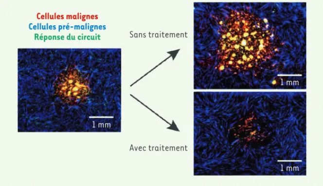 Figure 2. Ciblage thérapeutique de cellules de tumeur du poumon. L’évolution des « tumeurs »  (en rouge, sur l’image de gauche à 5 jours) est suivie par microscopie de fluorescence pendant  environ un mois (images de droite à 15 jours)