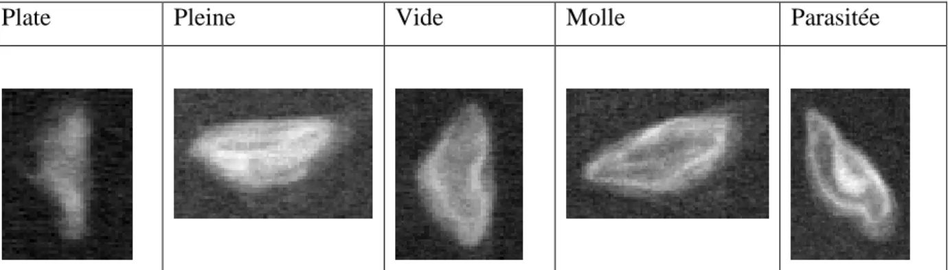 Tableau 1 : Distinction des différents types de graines à la radiographie. 