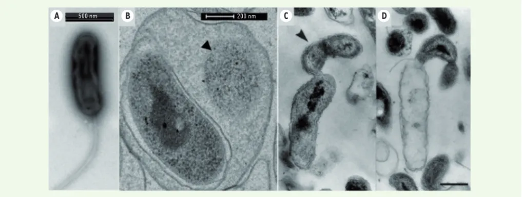 Figure 2. Observation en microscopie électronique à transmission de la phase d’attaque (A) et de la phase de croissance (B) du prédateur péri- péri-plasmique Bdellovibrio bacteriovorus HD100 dans le périplasme d’une cellule d’Escherichia coli