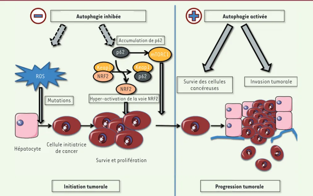 Figure 4. L’autophagie dans la carcinogenèse hépatique : un rôle protecteur dans l’initiation mais facilitateur dans l’invasion tumorale ? L’inhi- L’inhi-bition de l’autophagie favorise la production de ROS (espèces réactives de l’oxygène) dues à la baisse