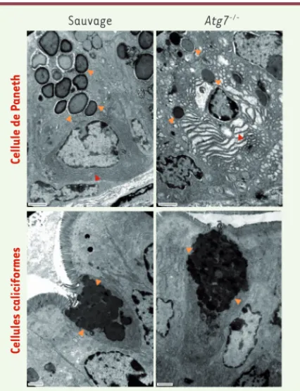 Figure 1.  Effets de la perte de gènes de l’autophagie dans la  fonction des cellules épithéliales sécrétrices