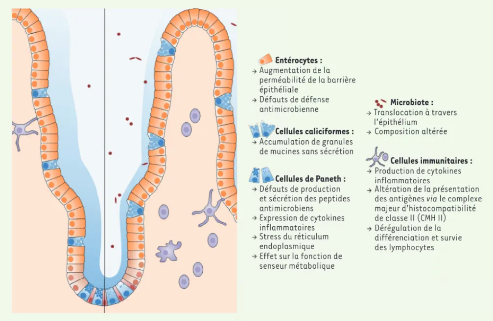 Figure 2. Conséquences de l’inhibition de l’autophagie dans l’épithélium intestinal. Un blocage de l’autophagie entraîne de nombreuses perturba- perturba-tions de l’homéostasie intestinale