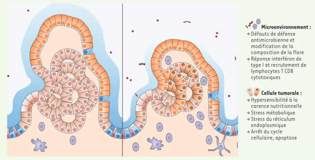 Figure 3. Effets anti-tumoraux de l’inhibition de l’autophagie dans l’épithélium intestinal