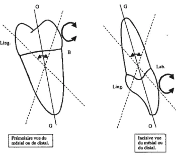 Figure 1: Inclinaison labio-linguale (Remise, 2002)