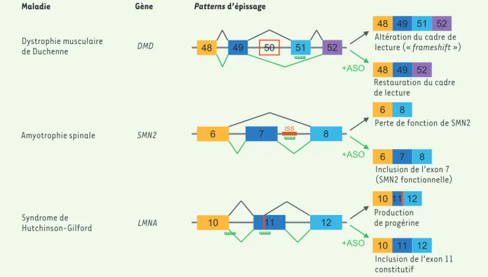 Figure 4.  Utilisation des oligonucléotides antisens (ASO) pour corriger les événements d’épissage aberrants