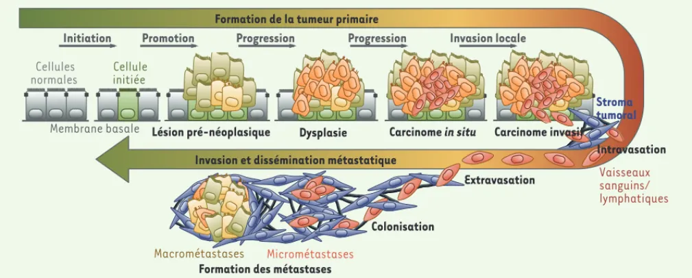 Figure 1. Principales étapes du développement d’une tumeur d’origine épithéliale et de la cascade métastatique