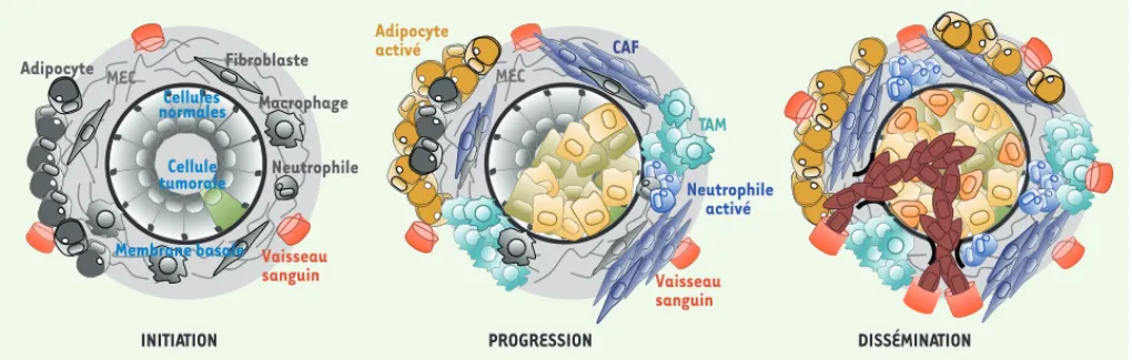 Figure 3. Rôle du stroma au cours de la progression tumorale. Le stroma et la matrice extracellulaire (MEC) subissent d’importantes modifications  au cours de la tumorigenèse et de la dissémination des cellules cancéreuses