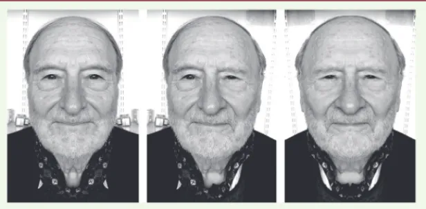 Figure 1. Visage illustrant l’asymétrie imparfaite. Au centre, le visage original, à gauche,  le visage symétrisé droit, et à droite le visage symétrisé gauche.