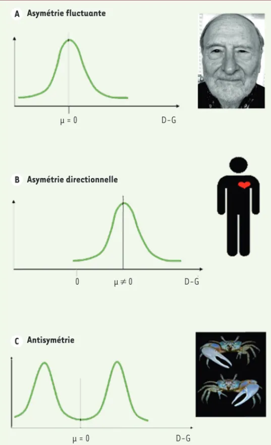 Figure 2. Les trois types d’asymétrie biologique. Pour les trois distributions,  l’ordonnée indique la fréquence