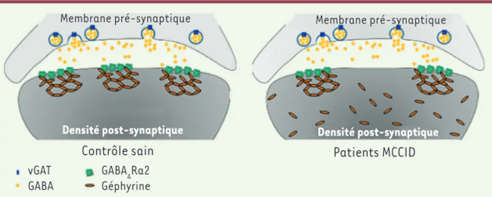 Figure 1. Modélisation de l’anomalie structurelle des synapses chez les patients MCCDI