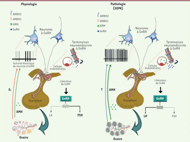 Figure 1.  Représentation schématique du mécanisme d’action proposé de l’AMH sur les neurones à GnRH des femmes à ovaire normal et des  femmes avec un syndrome des ovaires polykystiques (SOPK)