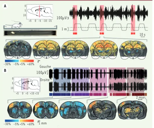 Figure 2. Navigation spatiale et crises épilep- épilep-tiques. Les plans d’imagerie, coronaux, sont  indiqués sur les vues de côté du cerveau dans  les encadrés